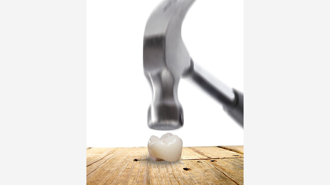 zirconia strong teeth crown rajkot gujarat